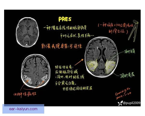 楚阿梅尼伤病情况仍需密切关注，状态恢复进展渐显积极信号